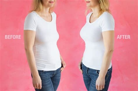 breast expansion meaning|Breast Augmentation: What You Should Know